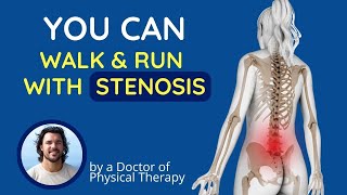 How to Walk and Run with Stenosis or Spondylolisthesis  Posture Correction [upl. by Ferneau991]