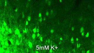 Improved adult brain slice method Ca imaging cortexwmv [upl. by Hands574]