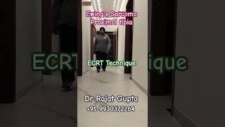 Ewing Sarcoma proximal tibia cured with ECRT Technique  Dr Rajat Gupta bonecancerclinic [upl. by Razaele246]