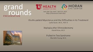 Case Presentations Ocullopalatal Myoclonus Diplopia after Ethmoidectomy PulledinTwo Syndrome [upl. by Nosremaj821]