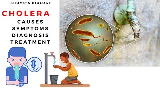 Vibrio cholera causes symptoms prevention and diagnosis [upl. by Nipsirc]