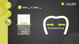 Einfach erklärt Was ist WAK in Zusammenhang mit der Zahntechnik [upl. by Anialam]