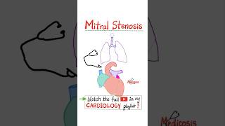 Mitral Stenosis MS  Valvular Heart Diseases VHD Part 1 …cardiology cardio anatomy nurse [upl. by Deyes]