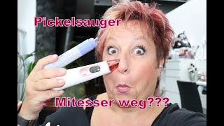 PickelPorensauger Test braucht man das wirklich Absaugen  Entfernung von Mitessern [upl. by Aivax253]