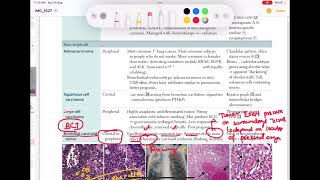 Bronchial Carcinoid tumor Respiratory 56  First Aid USMLE Step 1 in UrduHindi [upl. by Cire]