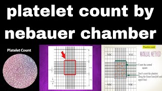 platelet count by nebauer chamber  in hindi  ph patho hub  thrombocytes count  Dmlt  Bmlt [upl. by Atimed]