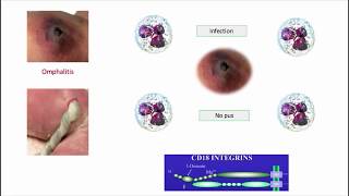 12DaysinMarch Immunodeficiencies Part II for the USMLE Step One Exam [upl. by Noeht]