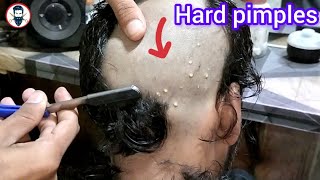 Bald HeadShave for Men🙄how to Attractive Hard pimple removal head shave for old men tutorial 2024😱 [upl. by Benis71]