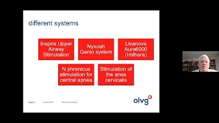 Sleep surgery in OSA – Inspire upper airway stimulation [upl. by Muriel]