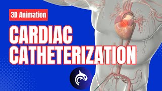 Cardiac Catheterization  3D Animation [upl. by Atteniuq]