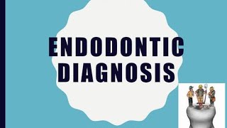 Endodontic diagnosis pulp and periapical tests [upl. by Ygief]