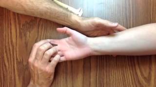 Hand Exam For Carpal Tunnel Syndrome [upl. by Kcirdahc990]