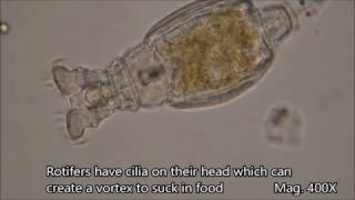 Rotifers under the microscope [upl. by Fidelis514]