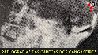 RADIOGRAFIAS DAS CABEÇAS DOS CANGACEIROS  CNL  892 [upl. by Nytsud]