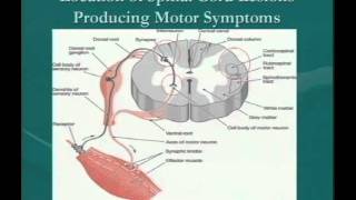 Clinical Significance of Demyelinating Lesions of the Central Nervous System [upl. by Ecnarolf]