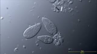 Small Marine Ciliates ciliophora  Structure cilia macronucleus vacuoles DIC microscopy 4K [upl. by Alburg]