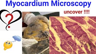 MYOCARDIUM WHAT IS THIS [upl. by Meyeroff444]