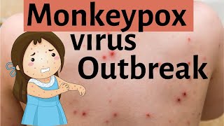 Monkeypox virus outbreak  What is monkeypox virus [upl. by Peednas]