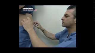 Lipolyse de labdomen par le Docteur Thierry LAFITTE TV5 Mondemp4 [upl. by Eimmelc]