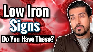 7 SIGNS of Iron Deficiency to Catch Now  Iron Deficiency Without Anemia [upl. by Micco]