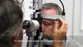 Slit Lamp setup and fundal assessment with a 90d lens [upl. by Neelhsa]