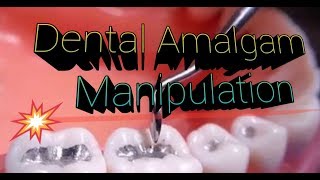 Dental Amalgam Manipulation [upl. by Harbert510]