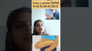 Twins c section delivery ke baad pet kitne dino me kam hota hai twins c section delivery ke baad pet [upl. by Colb]