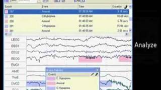 Great Lakes NeuroTechnologies BioCapture [upl. by Finkelstein]