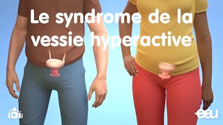 Le syndrome de la vessie hyperactive OAB pour overactive bladder [upl. by Eekcaj713]