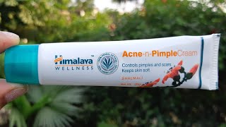 Himalaya herbals acne amp pimple cream review anti acne cream for summers for everyone [upl. by Peckham]