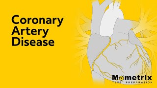 Coronary Artery Disease  NCLEX Review [upl. by Jedd991]