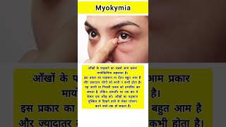 Whats myokymia healthfacts health medical medicalfacts healthcare medicaleducation shorts [upl. by Wiskind]