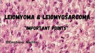 Leiomyoma and Leiomyosarcoma  Reproductive Pathology  emotionalmedico [upl. by Darrel]