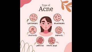 Type Of Acne [upl. by Eemyaj]