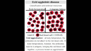 Cold Agglutinin Disease autoimmune hemolytic anemia Mycoplasma Pneumoniae amp Mononucleosis [upl. by Meesak]