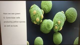 Saccharomyces Cerevisiae Presentation [upl. by Wise]