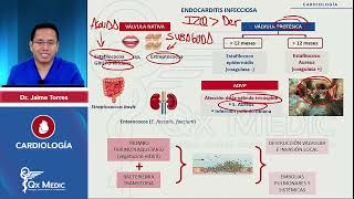 CARDIOLOGÍA Endocarditis infecciosa Endocarditis infecciosa mp4 [upl. by Edbert]