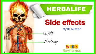 Herbalife nutrition side effects हर्बलाइफ के साइड इफैक्ट्स Nav fitness [upl. by Worrad]