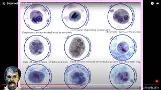 Diagnostic Parasitology Entamoeba histolyticaCourse [upl. by Nebuer]