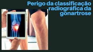 Perigo da classificação radiográfica da artrose [upl. by Mchale]