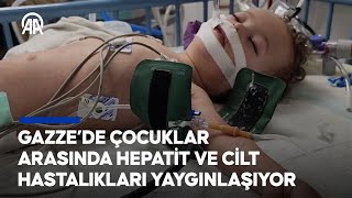 Gazze’de çocuklar arasında Hepatit ve cilt hastalıkları yaygınlaşıyor [upl. by Annabel]