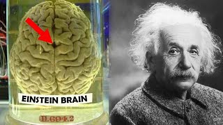 The Unique Brain of Einstein Unraveling the Mystery of Genius einsteinbrain geniusmindset [upl. by Valda234]