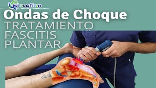 ONDAS DE CHOQUE  TRATAMIENTO FASCITIS PLANTAR con ESPOLON CALCANEO Fisioterapia  Fisiolution [upl. by Ocsic]