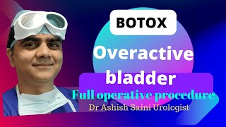 Botox for overactive bladder procedure [upl. by Illa]