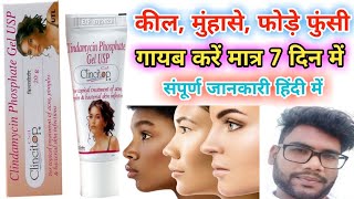 Clincitop gel uses and side effects  कील मुंहासे फोड़े फुन्शी की सबसे अच्छी क्रीम  Hindi review [upl. by Reese467]