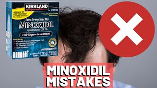 5 BIGGEST MISTAKES When Using Minoxidil REVEALED [upl. by Lyrak]