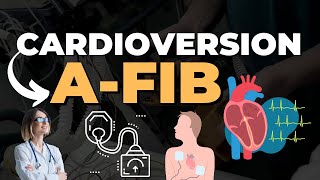 Cardioversion Procedure Steps and Video  E Healthy Info cardioversion [upl. by Tabbitha]