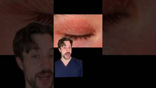 DERM REACTS 5 SURPRISING TIPS TO STOP ITCHY EYELIDS 🔥✨ Eyelid relief Derk reacts [upl. by Odlanar]