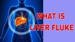 👍👍LIVER FLUKES IN HUMANS [upl. by Thorma404]