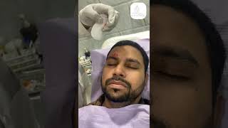 PRP Treatment for Scar Removal in Navi Mumbai shorts scarremoval [upl. by Latisha989]